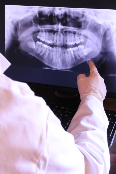 Best Cosmetic Emergency Dentistry in Cartervle, IL