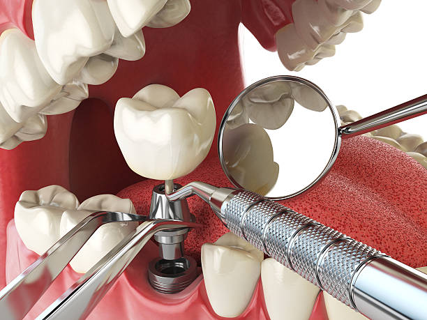 Best After-Hours Dental Trauma Care in Cartervle, IL